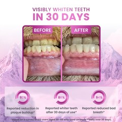 Larineco Remineralizing Gum with Nano Hydroxyapatite Xylitol – Sugar-Free Ci…