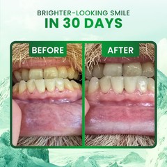 Remineralizing Gum with Nano Hydroxyapatite & Xylitol – Sugar-Free Peppermint