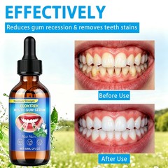 Gum Restore Drops – Advanced Repair for Receding Gums & Stain Removal – Bad B…